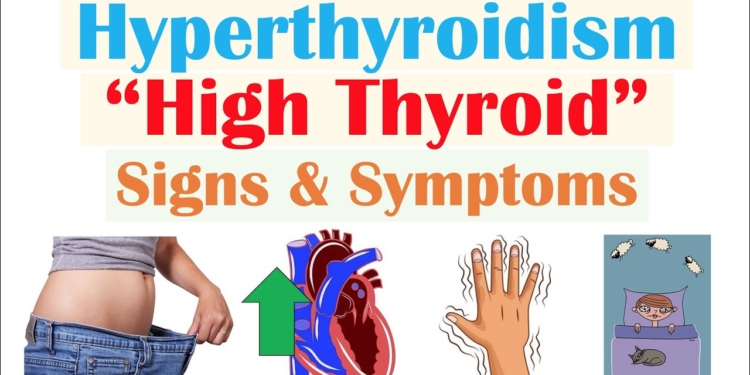Hyperthyroidism & Thyroid Storm Signs & Symptoms (& Why They Occur)