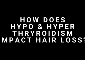 How Does Hyper and Hypo Thyroidism Impact Hair Loss?
