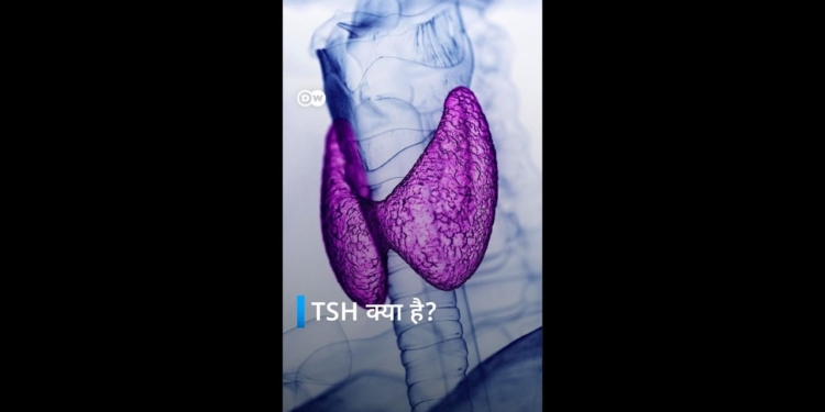 TSH क्या होता है? [Things you need to know about TSH | Sehat Talk | Isha Bhatia]