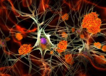 Alzheimer's Signs Hidden in Midlife Brains, Study Shows
