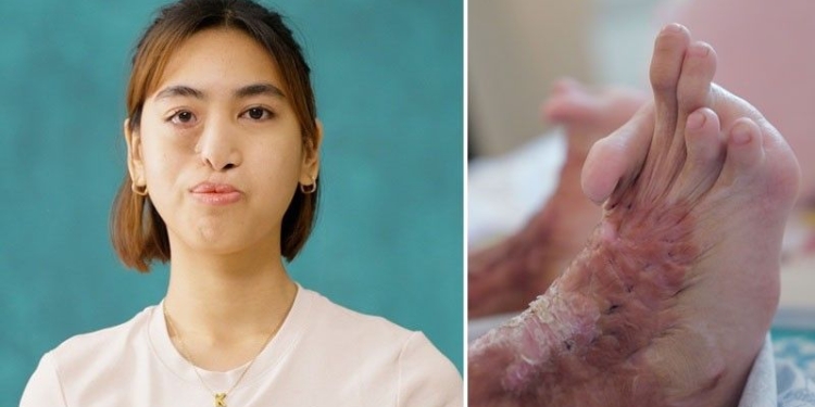 Belo performs first-ever facial bone reconstruction using custom 3D-printed implant in landmark scar project case