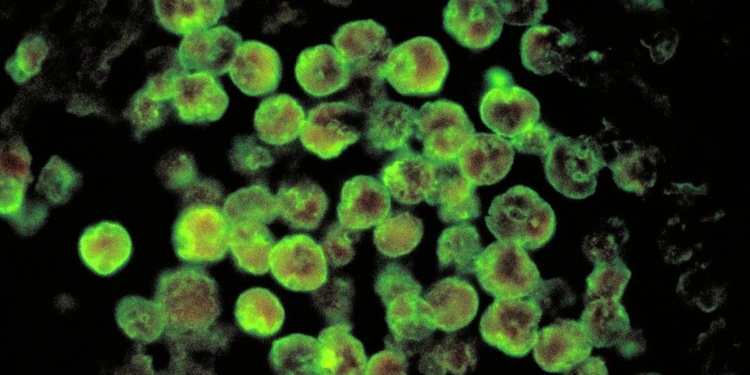 Brain-eating amoeba: Kerala reports another death from amoebic meningoencephalitis
