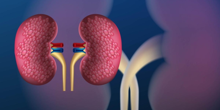 Children are now getting kidney stones: what needs to change to prevent this