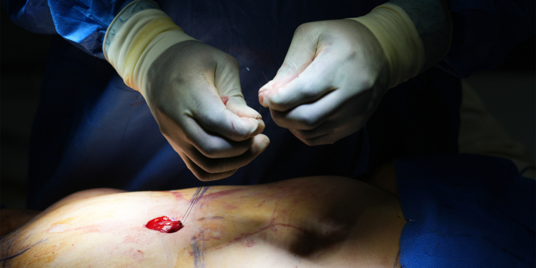 Cosmetic Interventions Are Booming. Many Say Ethical Conversations Are Lagging.