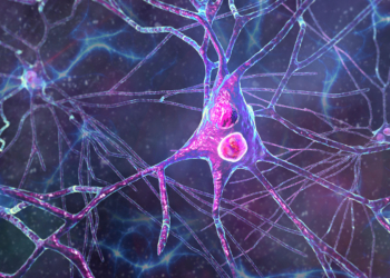 Dementia With Lewy Bodies May Be More Common Than We Think