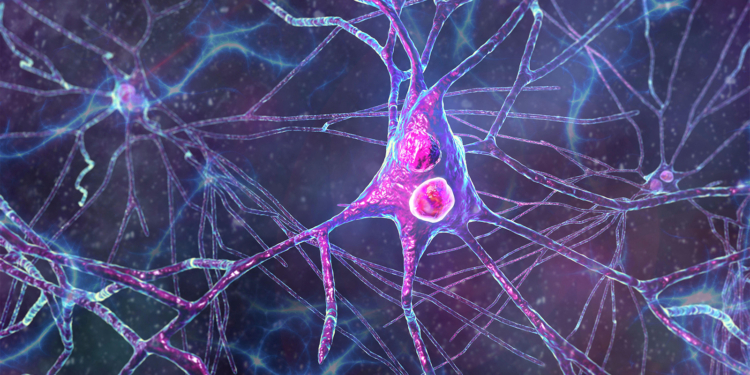 Dementia With Lewy Bodies May Be More Common Than We Think