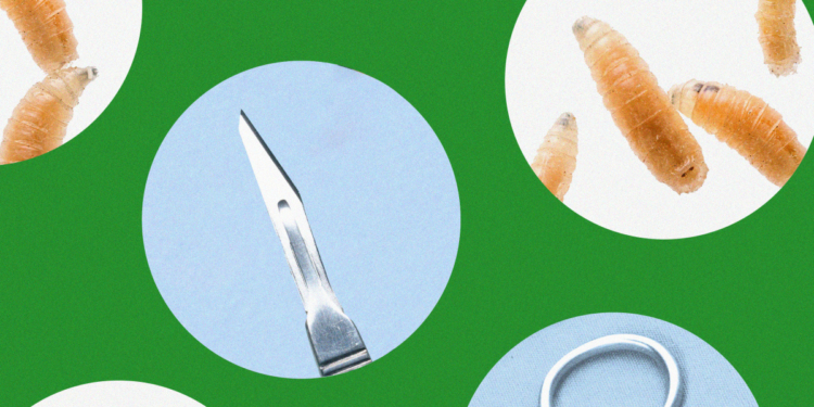 Got maggots? These doctors are bringing the bugs into their practice on purpose