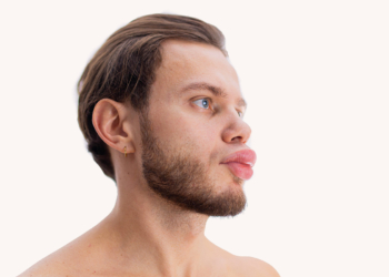 Hereditary Angioedema Prophylaxis: Persistence and Adherence
