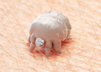In Severe Scabies, Standard-Dose Ivermectin Superior to High Dose