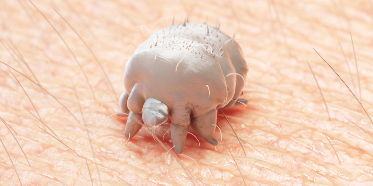 In Severe Scabies, Standard-Dose Ivermectin Superior to High Dose