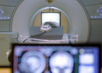 Low accumulation of abdominal fat in midlife linked with slow brain atrophy, study finds