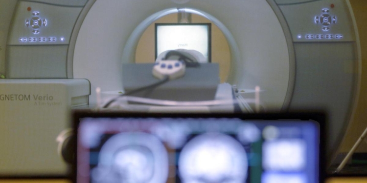 Low accumulation of abdominal fat in midlife linked with slow brain atrophy, study finds
