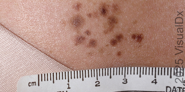 Make the Diagnosis: This Is a Curious Cluster. Can You Diagnose It?