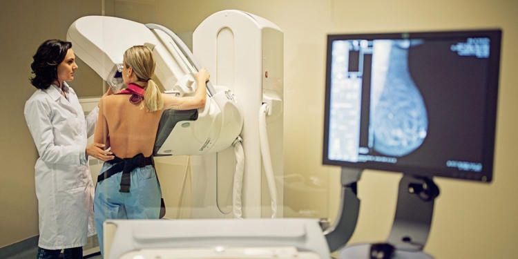New Drug Reduces Breast Density With Fewer Side Effects