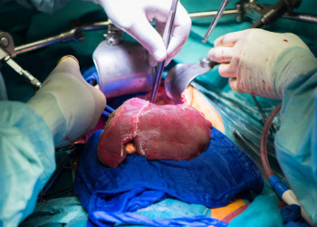 Perfusion Preservation Strategy Boosts Liver Transplant Outcomes