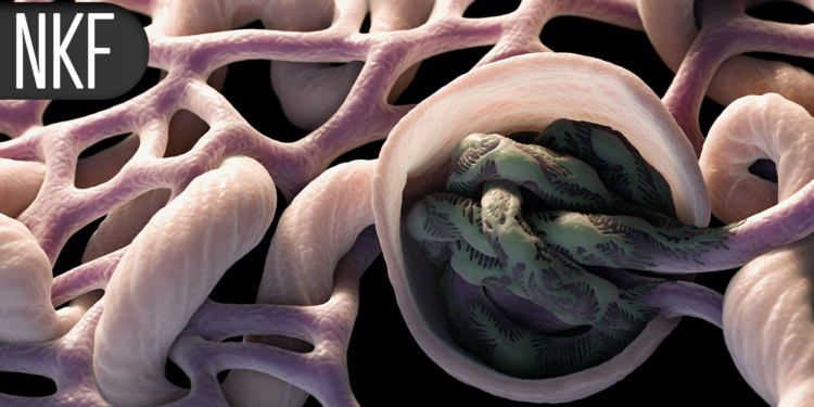 Protein Supplement Tied to Better Outcomes for Patients on Dialysis