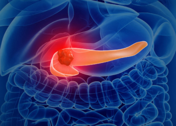 Safety Data on the Novel Pancreatic Cancer Drug Available by Early Access