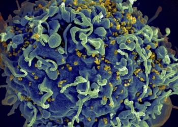 Small study hints that revving up immune cells might help fight HIV