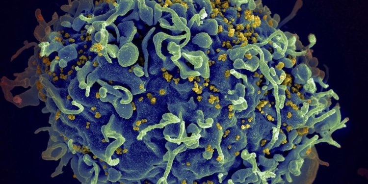 Small study hints that revving up immune cells might help fight HIV