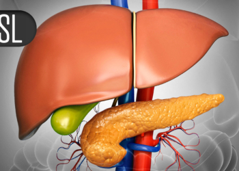 TIPS Was Tops for Refractory Hydrothorax in Cirrhosis