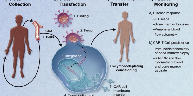 Understanding the potential of CAR-T therapy in autoimmune disease treatment