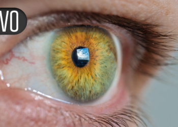 Vision-Threatening Forms of Diabetic Retinal Disease Have Plummeted