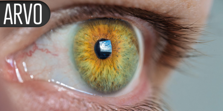 Vision-Threatening Forms of Diabetic Retinal Disease Have Plummeted
