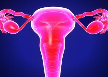 Why ovarian cancer needs a louder voice