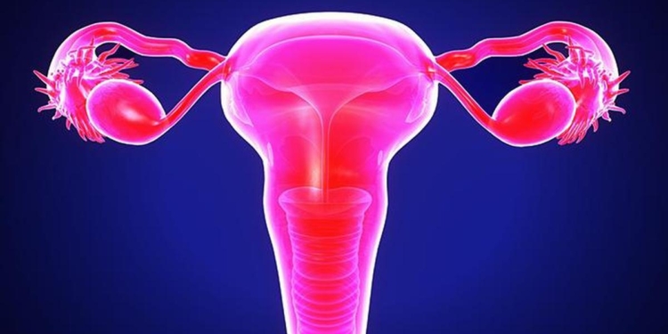 Why ovarian cancer needs a louder voice