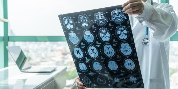 World Health Assembly recognises stroke as a public health priority for the first time