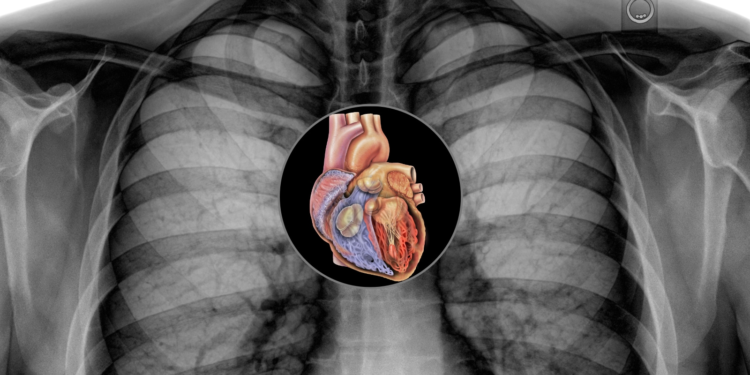 heart